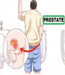 Tout savoir sur la Maladie de la prostate